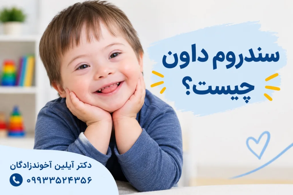 سندروم داون چیست؟